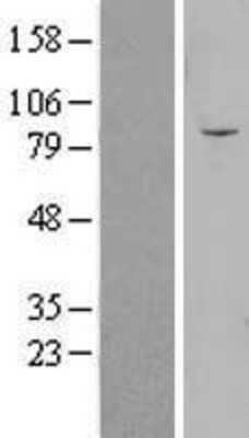 Western Blot: OLFML2B Overexpression Lysate [NBL1-13930]