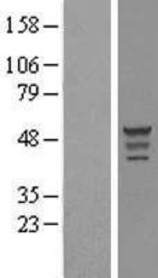 Western Blot: OLFM-L3 Overexpression Lysate [NBL1-13931]