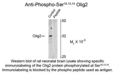 Western Blot: Olig2 [p Ser14, p Ser10, p Ser13] Antibody [NBP2-29523]