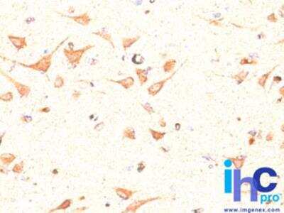 Immunohistochemistry-Paraffin: Olig2 Antibody [NBP2-27301]