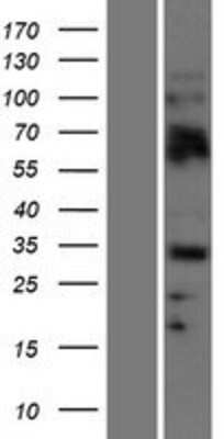 Western Blot: Olig2 Overexpression Lysate [NBP2-07699]