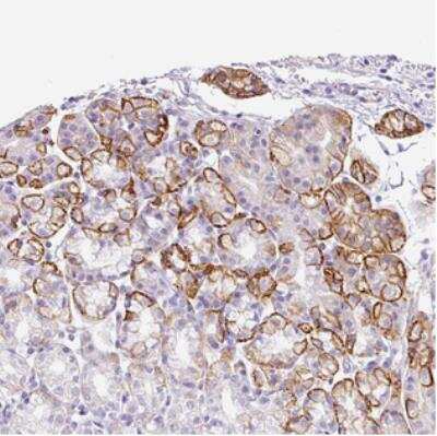 Immunohistochemistry: OLT-2 Antibody [NBP2-30758]