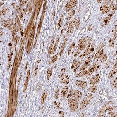 Immunohistochemistry: OLT-2 Antibody [NBP2-30759]