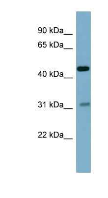 Western Blot: Osteoadherin/OSAD/OMD Antibody [NBP1-59166]