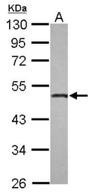 Western Blot: Osteoadherin/OSAD/OMD Antibody [NBP2-19627]