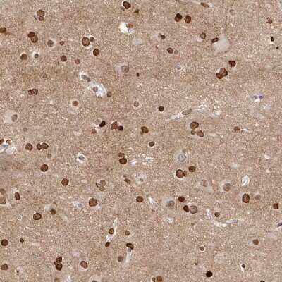 Immunohistochemistry-Paraffin: OMgp Antibody [NBP1-82484]