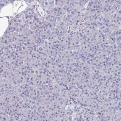 Immunohistochemistry-Paraffin: OMgp Antibody [NBP1-82484]