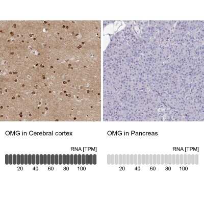 Immunohistochemistry-Paraffin: OMgp Antibody [NBP1-82484]