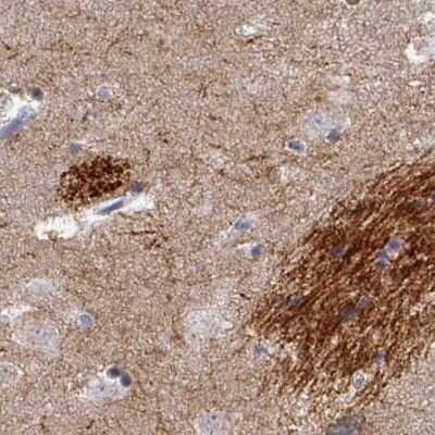 Immunohistochemistry-Paraffin: OMgp Antibody [NBP1-82484]