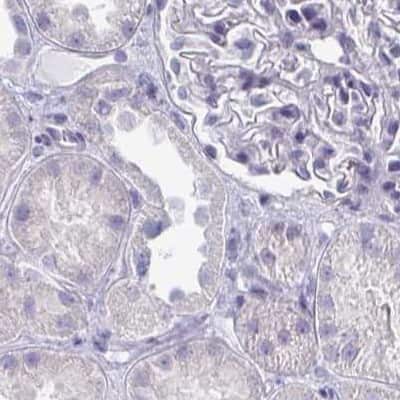 Immunohistochemistry-Paraffin: OMgp Antibody [NBP1-82484]