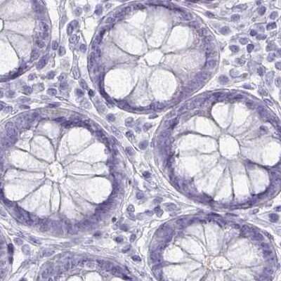 Immunohistochemistry-Paraffin: OMgp Antibody [NBP1-82484]