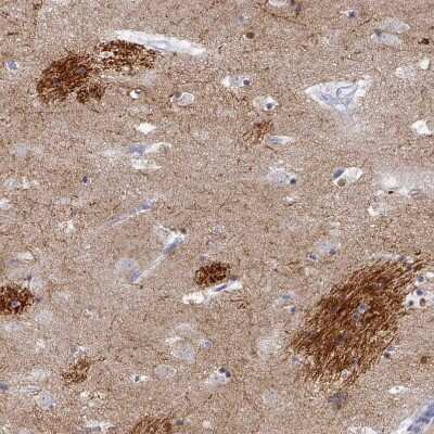 Immunohistochemistry-Paraffin: OMgp Antibody [NBP1-82484]