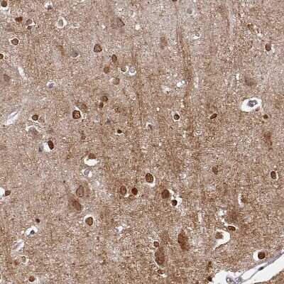 Immunohistochemistry-Paraffin: OMgp Antibody [NBP1-82484]