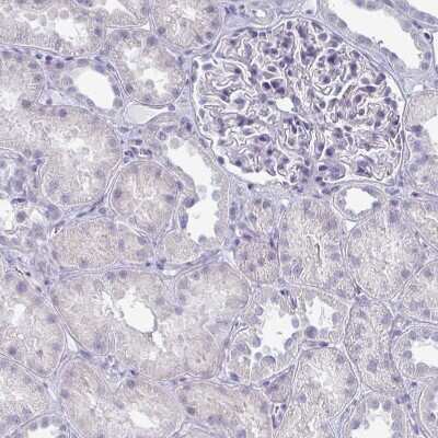 Immunohistochemistry-Paraffin: OMgp Antibody [NBP1-82484]