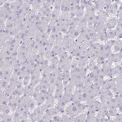 Immunohistochemistry-Paraffin: OMgp Antibody [NBP1-82484]