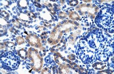 Immunohistochemistry: ONECUT2/OC-2 Antibody [NBP2-87944]