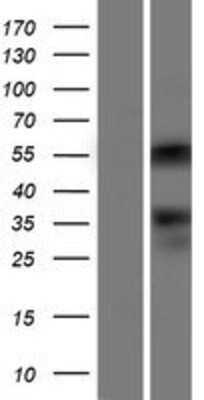 Western Blot: ONECUT2/OC-2 Overexpression Lysate [NBP2-07814]