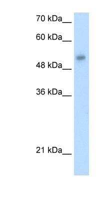 Western Blot: ONECUT3 Antibody [NBP1-91528]