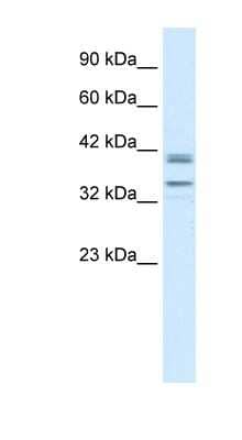 Western Blot: ONECUT3 Antibody [NBP1-91529]