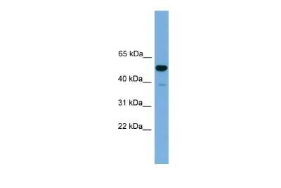 Western Blot: ONECUT3 Antibody [NBP3-10439]