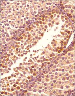 Immunohistochemistry-Paraffin: OPA1 Antibody (1284B) - BSA Free [NBP2-59770]