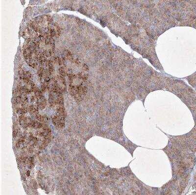 Immunohistochemistry-Paraffin: OPA1 Antibody [NBP2-34206]