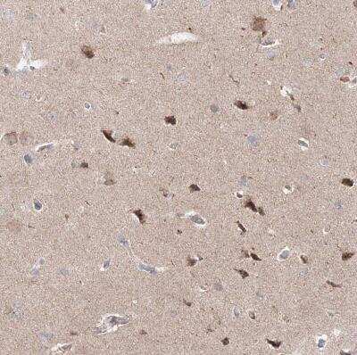 Immunohistochemistry-Paraffin: OPA1 Antibody [NBP2-34206]