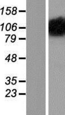 Western Blot: OPA1 Overexpression Lysate [NBP2-05723]