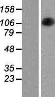 Western Blot: OPA1 Overexpression Lysate [NBP2-05726]