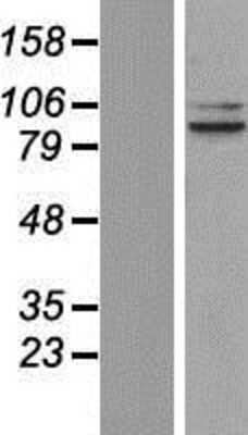 Western Blot: OPA1 Overexpression Lysate [NBP2-07150]