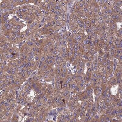Immunohistochemistry-Paraffin: OPA3 Antibody [NBP1-92221]