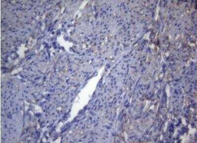 Immunohistochemistry-Paraffin: OPA3 Antibody (OTI3G4) [NBP2-46294]