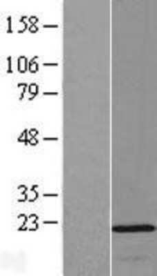 Western Blot: OPA3 Overexpression Lysate [NBL1-13938]