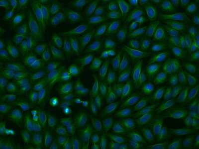 Immunocytochemistry/ Immunofluorescence: OPAL1 Antibody [NBP2-98185]