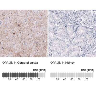 Immunohistochemistry-Paraffin: OPALIN Antibody (CL11144) [NBP3-07995]
