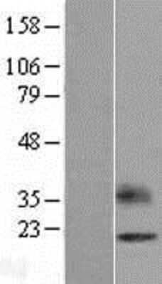 Western Blot: OPALIN Overexpression Lysate [NBL1-13939]