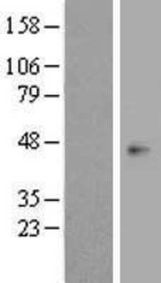 Western Blot: OBCAM/OPCML Overexpression Lysate [NBP2-08098]