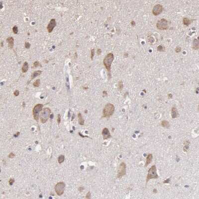 Immunohistochemistry-Paraffin: OPHN1 Antibody [NBP1-88828]