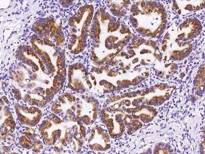 Immunohistochemistry-Paraffin: OPHN1 Antibody [NBP2-99305]