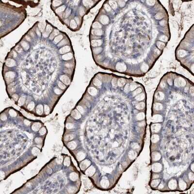 Immunohistochemistry-Paraffin: OPLAH Antibody [NBP2-47346]