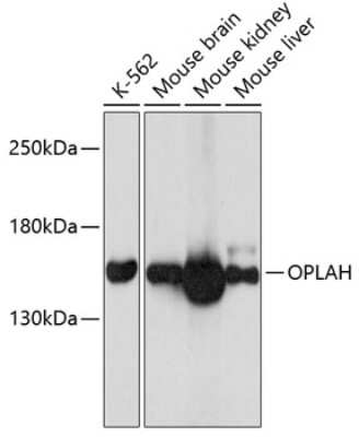 Western Blot: OPLAH AntibodyAzide and BSA Free [NBP2-93756]