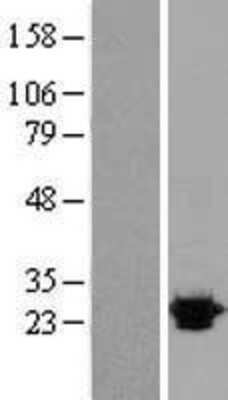 Western Blot: Sigma-1 R/OPRS1 Overexpression Lysate [NBL1-13947]