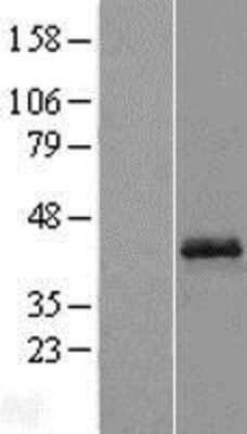 Western Blot: Opticin Overexpression Lysate [NBL1-13948]