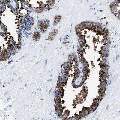 Immunohistochemistry: OR1-39 Antibody [NBP1-87376]