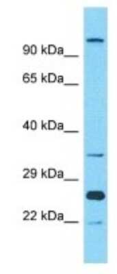 Western Blot: OR10A2 Antibody [NBP3-09842]