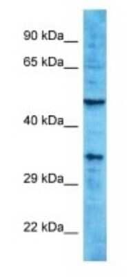 Western Blot: OR10A2 Antibody [NBP3-09843]