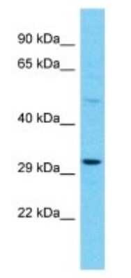 Western Blot: OR10A4 Antibody [NBP3-09845]