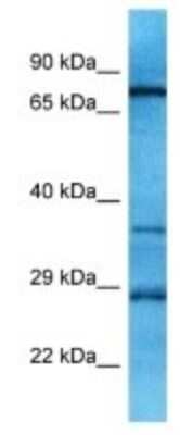 Western Blot: OR10A6 Antibody [NBP3-09846]