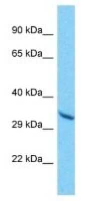 Western Blot: OR10A6 Antibody [NBP3-09847]