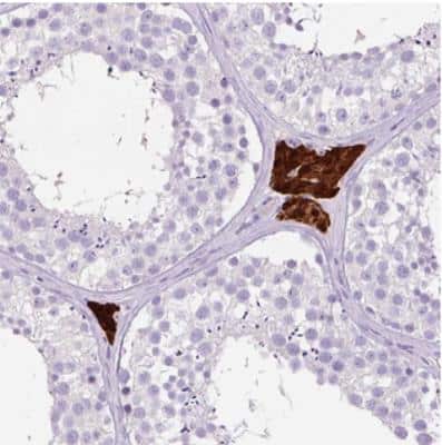 Immunohistochemistry: OR10A7 Antibody [NBP2-30798]